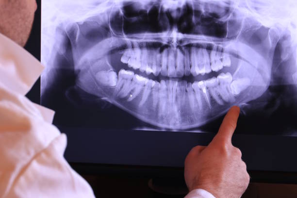 Best Emergency Dental Extractions in Towaoc, CO